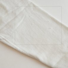 右ひじ付近に数か所キズ